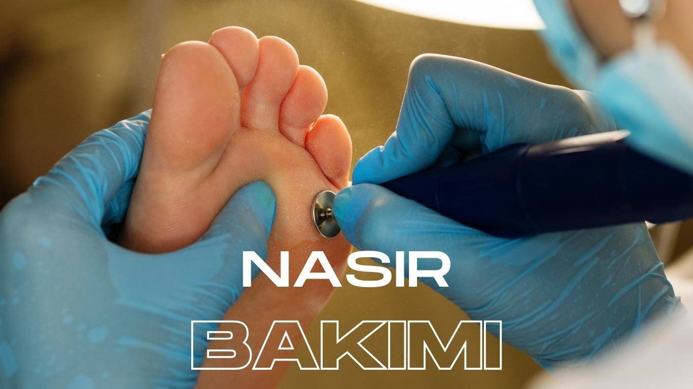 nasır bakımı