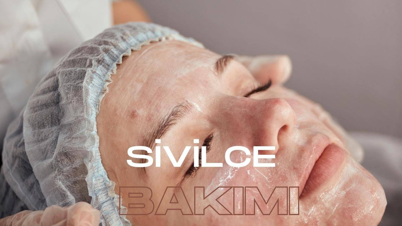sivilce bakımı